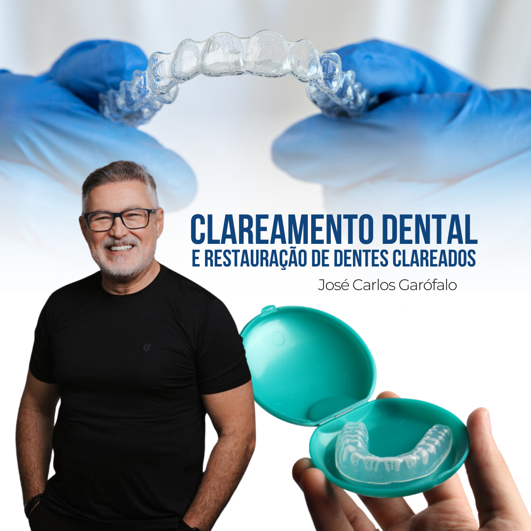 Clareamento Dental e Restauração de dentes Clareados