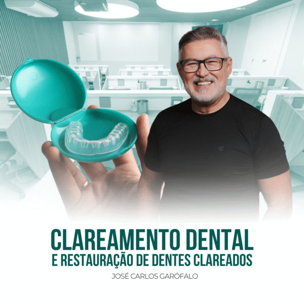 Clareamento Dental e Restauração de dentes Clareados