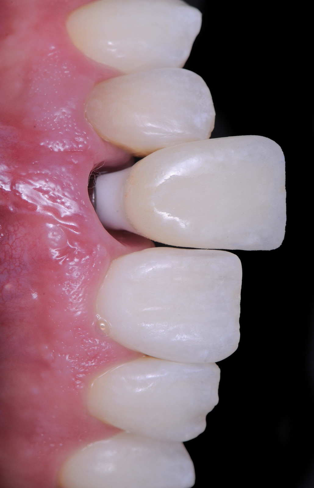 Quais componentes usar