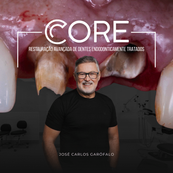 CORE – RESTAURAÇÃO AVANÇADA DE DENTES ENDODONTICAMENTE TRATADOS