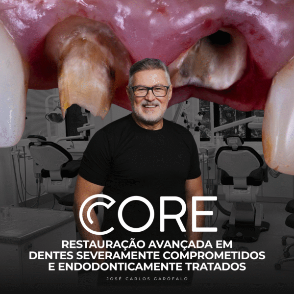 CORE – RESTAURAÇÃO AVANÇADA EM DENTES SEVERAMENTE COMPROMETIDOS E ENDODONTICAMENTE TRATADOS