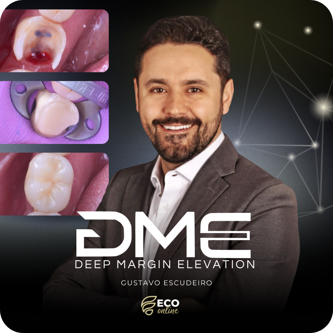 DME – Deep Margin Elevation