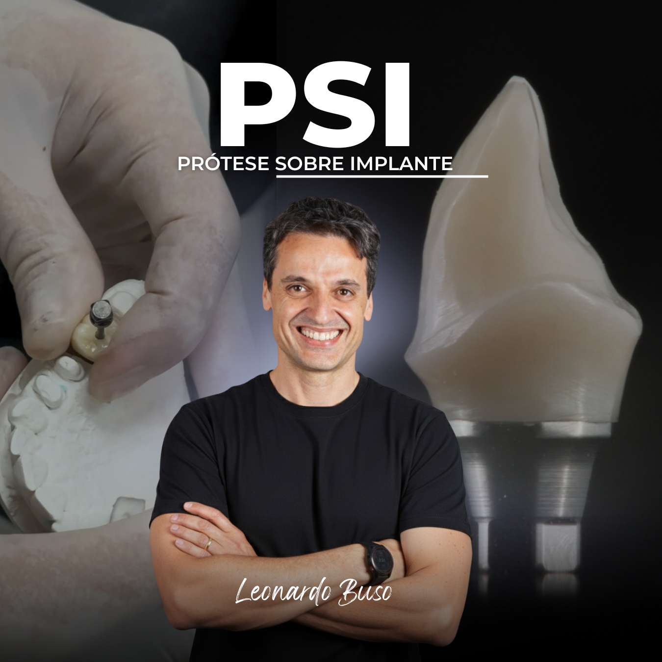 PSI – PRÓTESE SOBRE IMPLANTE