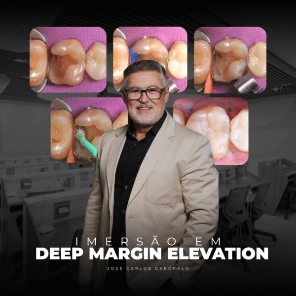 IMERSÃO EM DEEP MARGIN ELEVATION