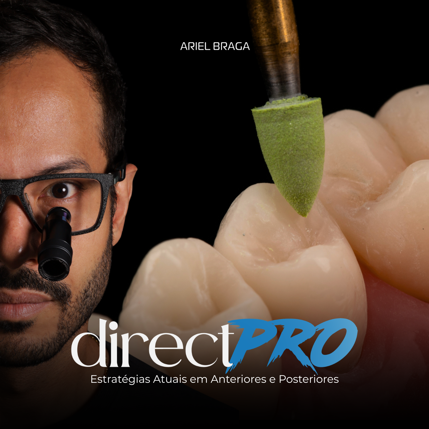DirectPRO: Estratégias Atuais em Anteriores e Posteriores