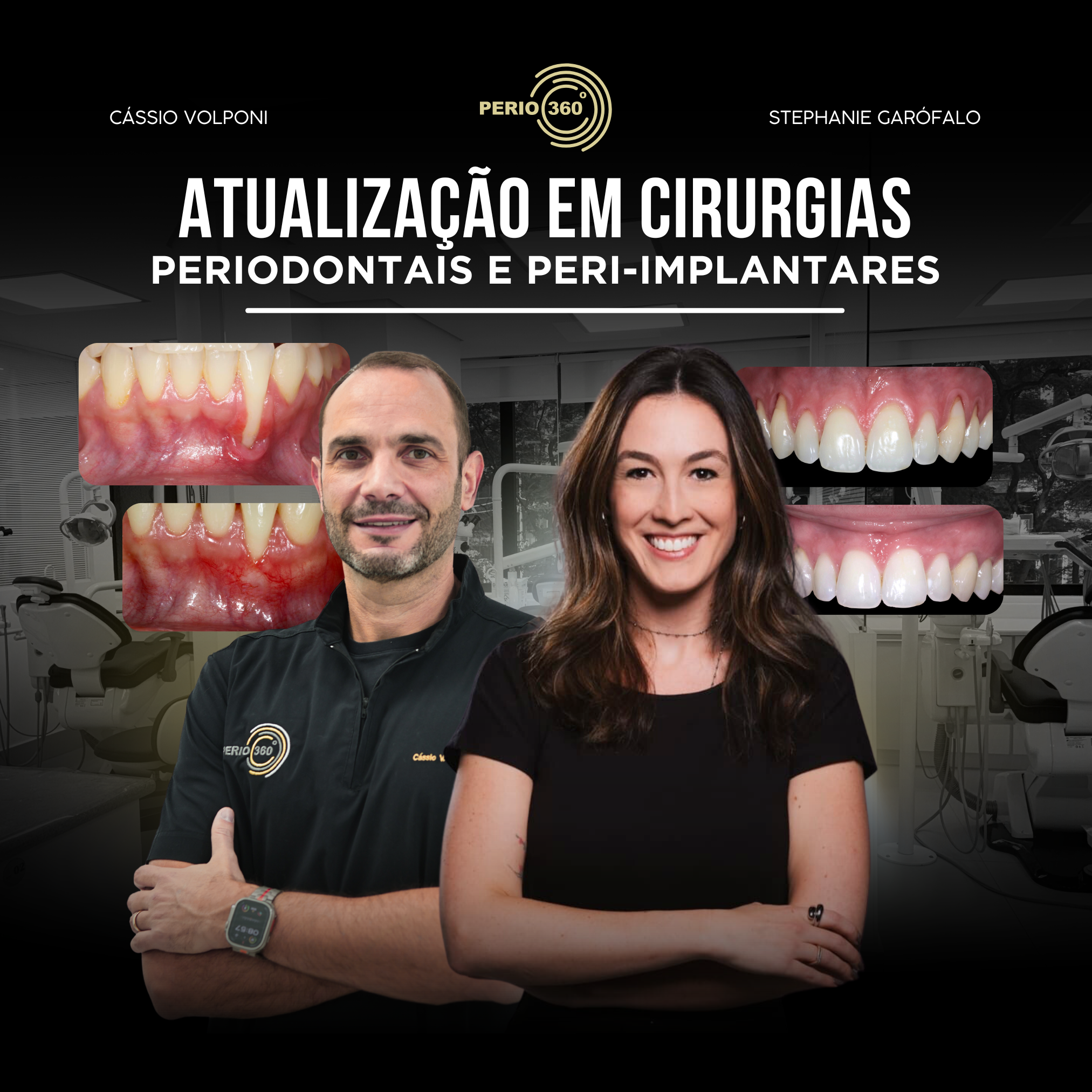 PERIO 360º – Atualização em Cirurgias Periodontais e Peri-implantares